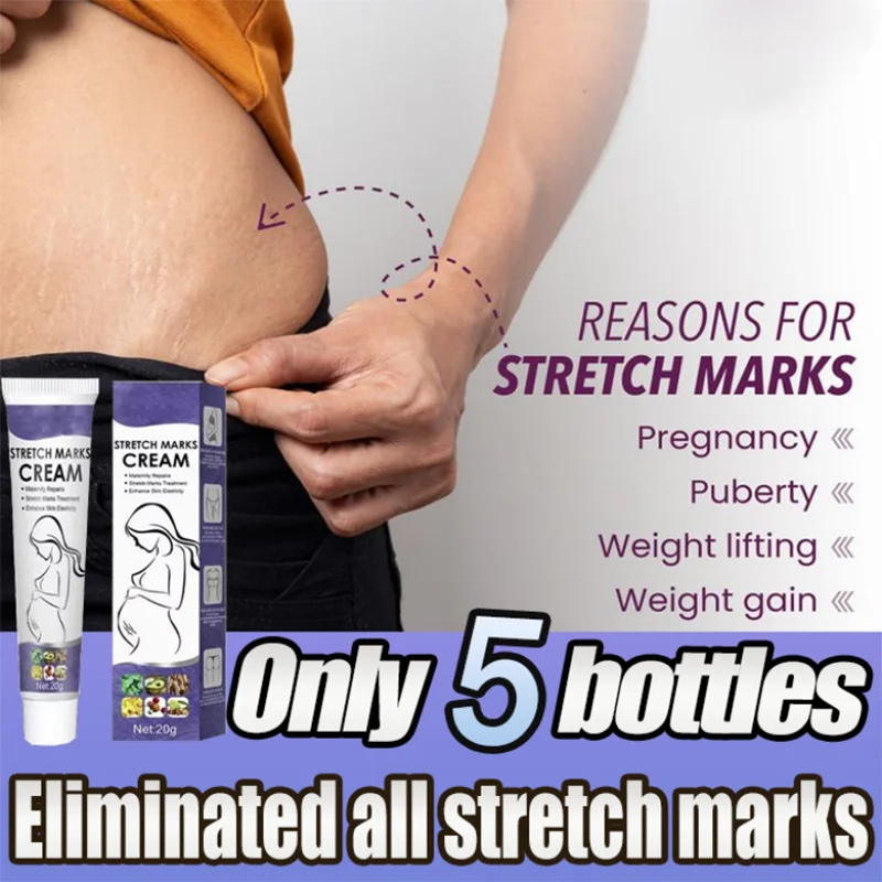 Pregnancy Repair Stretch Mark Removal Acne Scar Maternity Stretch Marks Remove Fat Striae Scars Treatment skin Care