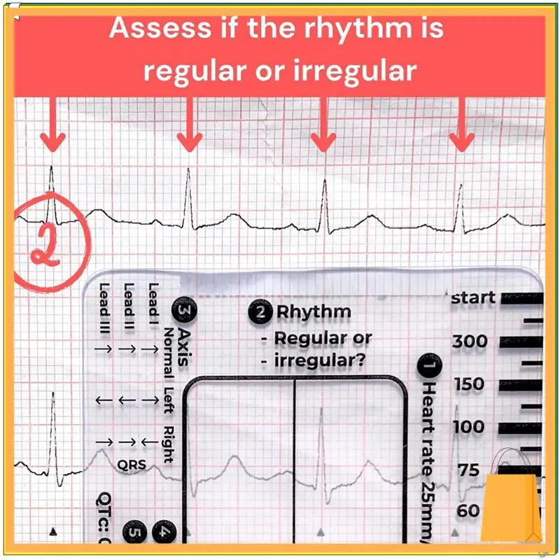 L52A-ECG 7-шаговая линейка, шаговая линейка ЭКГ 7-шаговая линейка для тердавления ЭКГ/ЭКГ, инструмент для быстрого и быстрого анализа кардиологии и измерения