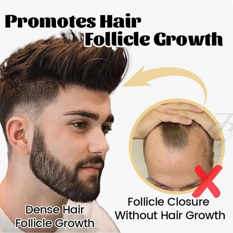 

There is hair all the time on the top of the head