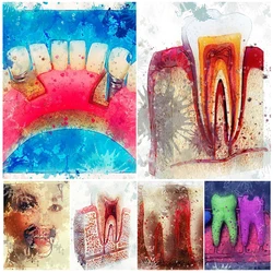 Watercolor Tooth Teeth Dentistry Clinic Poster Wall Art Canvas Painting Home Decor Wall Pictures For Living Room Unframed