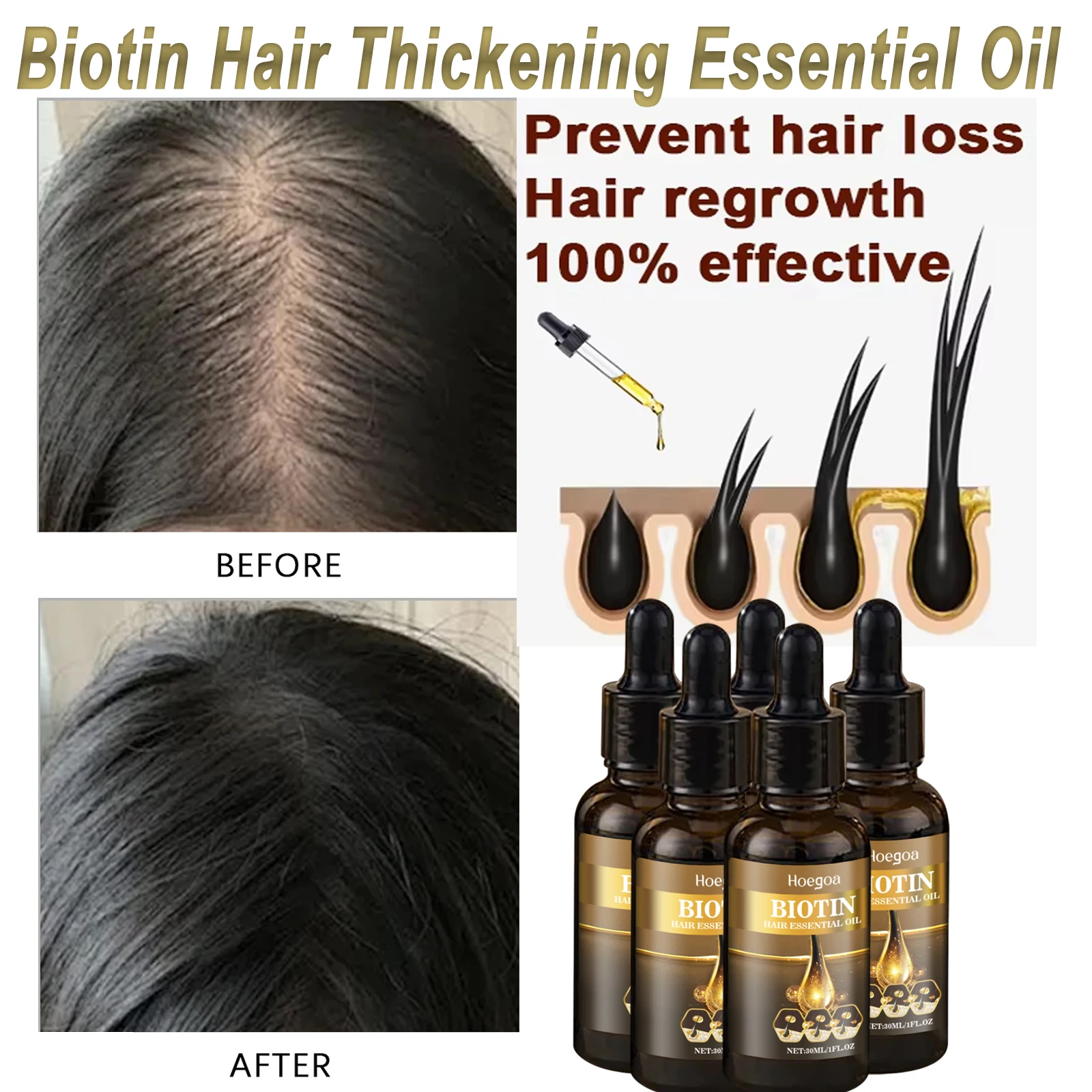 Repair Damaged Hair Roots Scalp Serum Biotin Essence Improve Androgenetic Alopecia Scalp Treatment Serum Strengthen Hair Roots