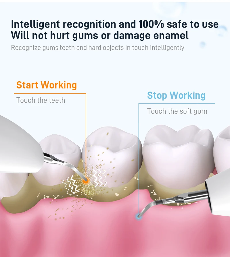 Schoben Ultraschall Dental Scaler für Zähne Zahnstein Plaque Flecken Reiniger Zahnstein elektrische Zahn Zahnstein entferner