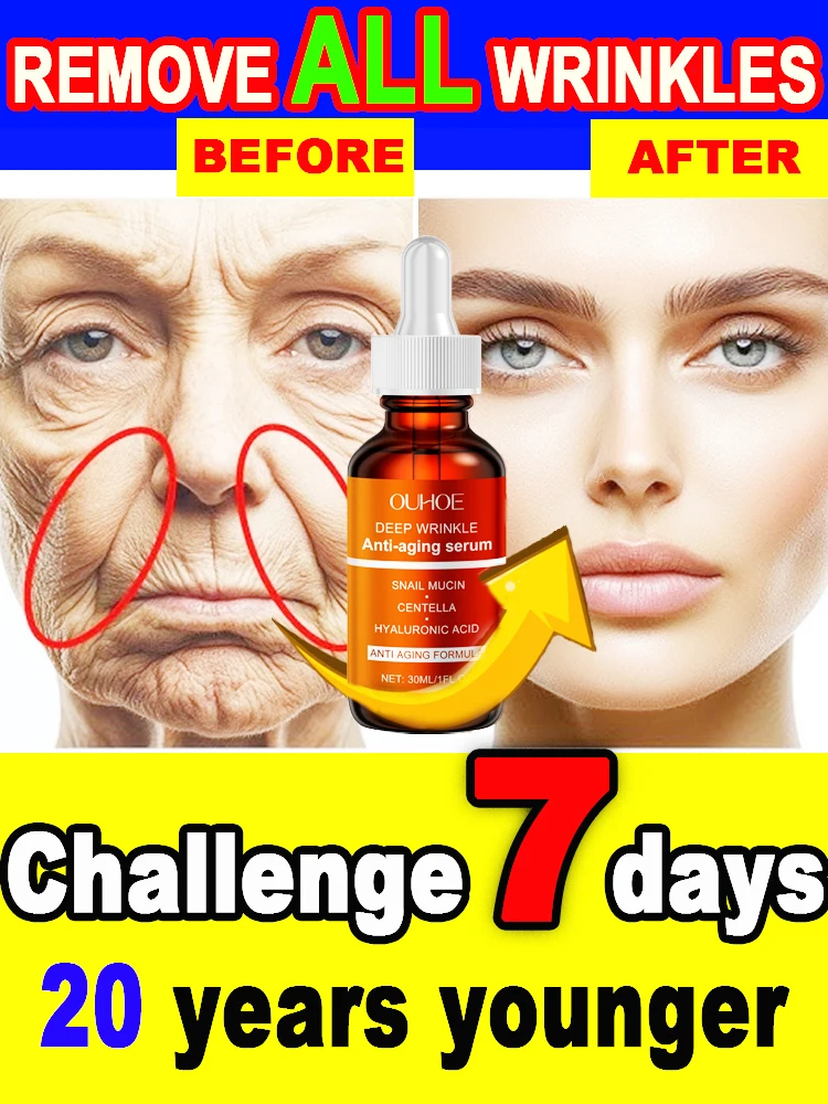 

Whitening Serum Effective Remove Dark Spots Freckles Fade Melanin Anti-Wrinkle Brightening Nourishing Face Wrinkles Disappeared