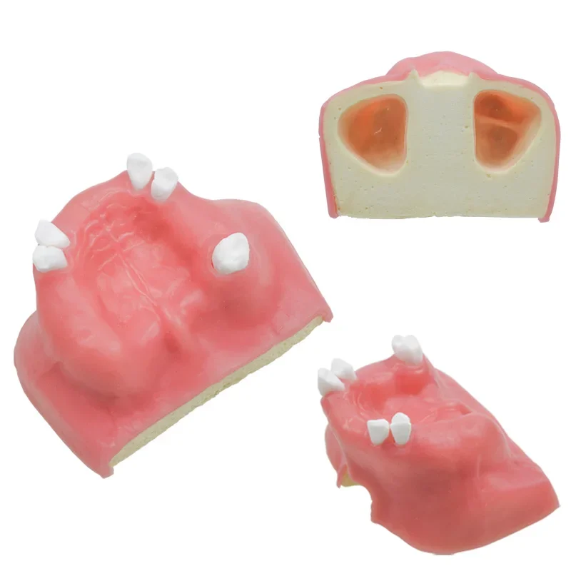 

Стоматологическая модель зубов верхнейщелярной пазухи, обучающая модель зубного имплантата, демонстрационная модель стоматолога, стоматологические материалы