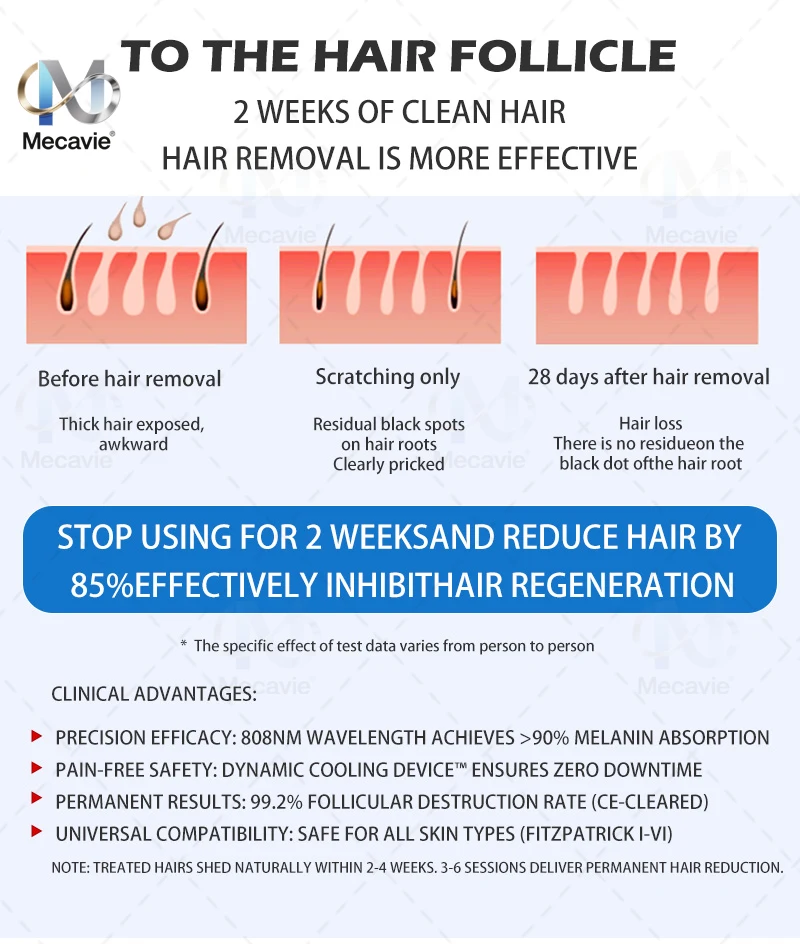 2026 أحدث إزالة الشعر بالليزر ديود سوبرانو الأول في العالم 2 في 1 غير مؤلم نقطة التجميد يزيل جميع الوشم قشر هوليوود #1