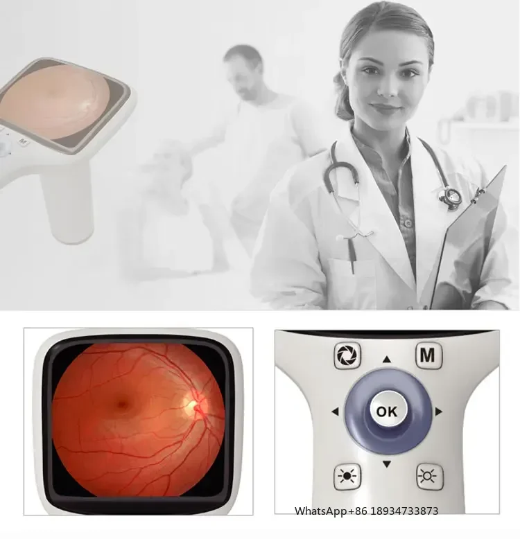 كاميرا شبكية رقمية محمولة باليد بدقة 42 درجة عالية الدقة لعام 2022 FC-100