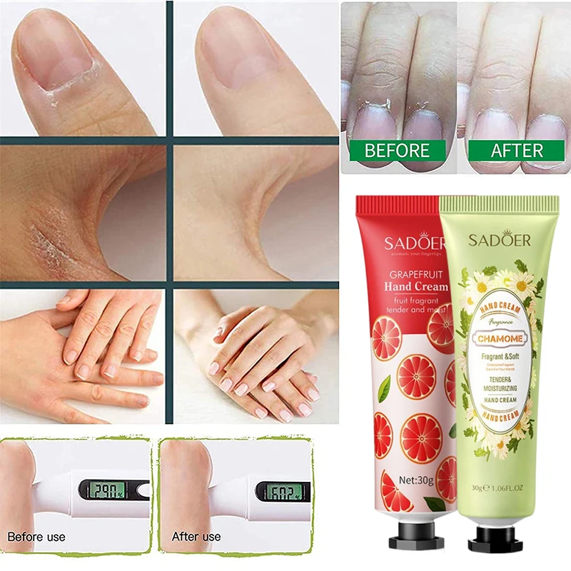 10 عبوات من كريم اليد لحماية الأيدي الجافة والمتشققة، لوشن مرطب لليدين مناسب للعناية ببشرة اليد المجففة والتجاعيد الجافة