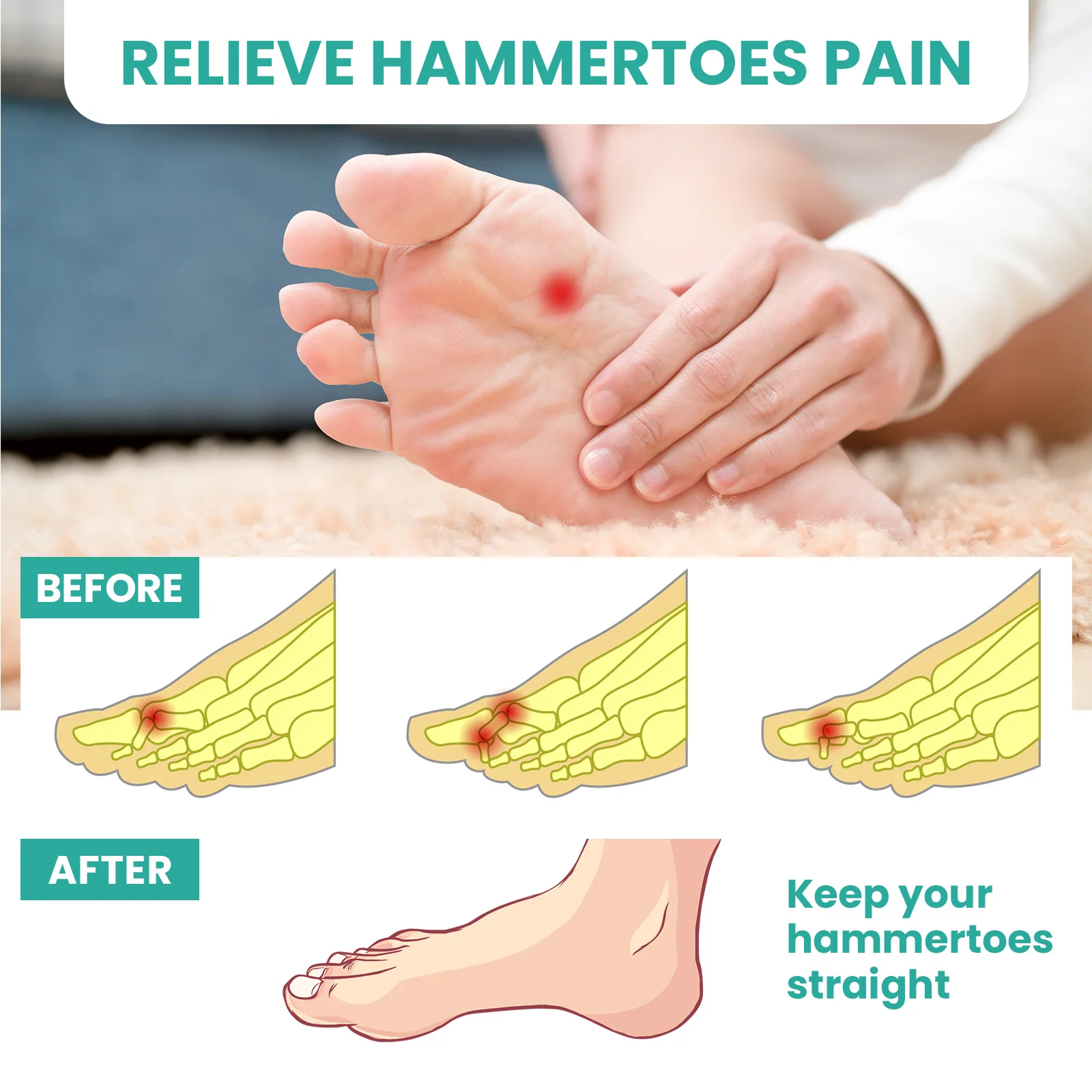 

1/2pairs Gel Hammer Toe Straightener Silicone Corrector for Curled Toes Feet Pain Relief Toe Separator Foot Care Tool Adjuster