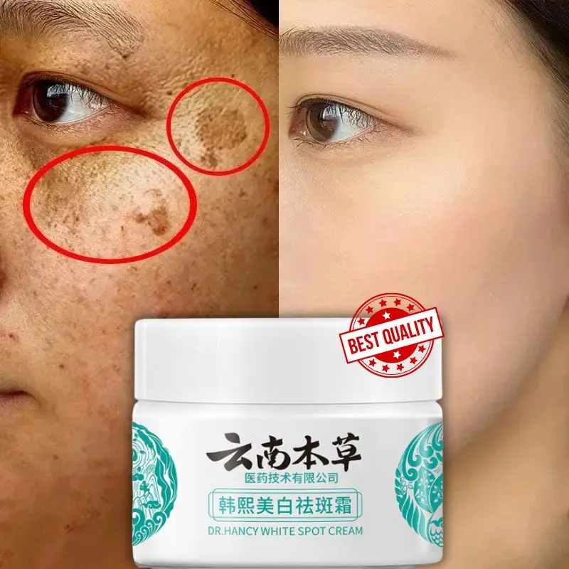 High-quality Niacinamide Melasma Brightening Cream Reduce Melanin Brighten Cream Lighten Dark Skin Chloasma Serum Fade Fine Line