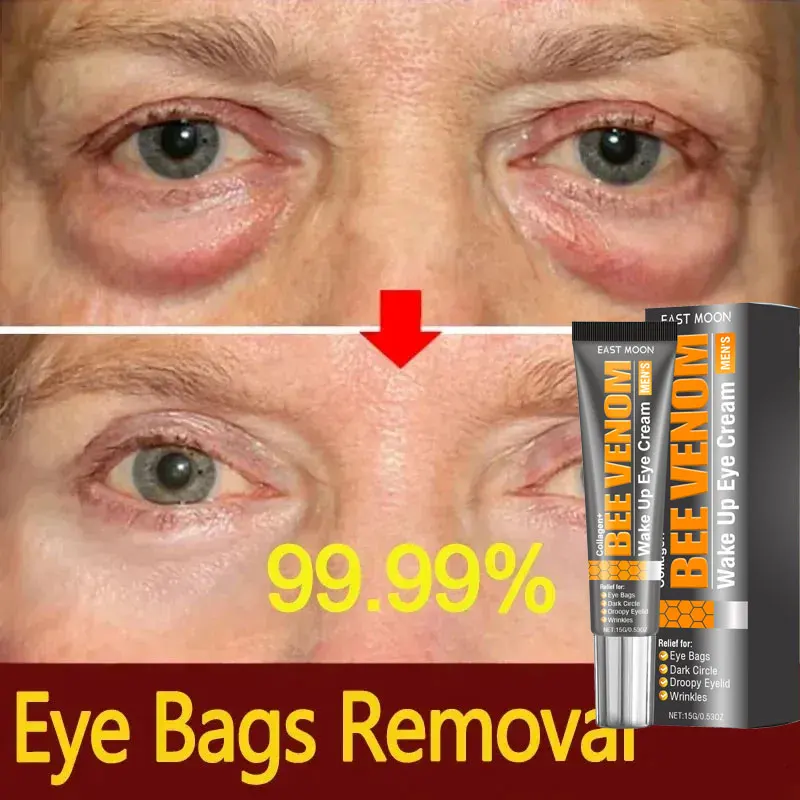 

Men Retinol Eye Bags Remover Cream Anti Dark Circles Anti Puffiness Fade Fine Line Lifting Firming Moisturizing Repair Skin Care