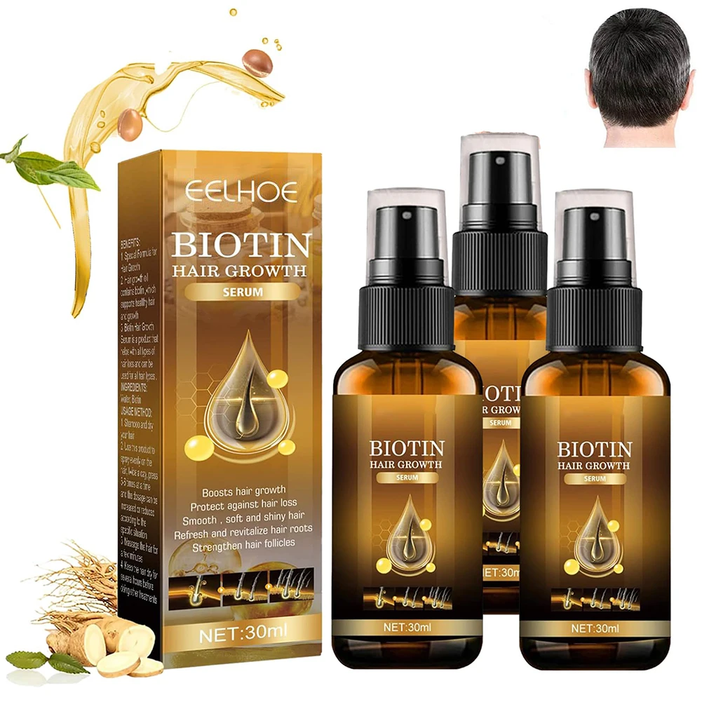 Produkte Biotin Verdickung Schnell wachsende Haarpflege Ätherische Öle Anti-Haarausfall-Spray Kopfhautbehandlung für Männer Frauen