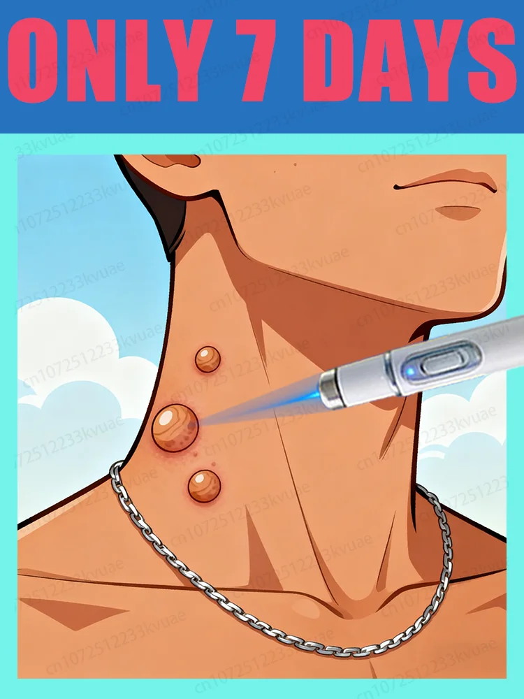 

Hot selling blue light pen to solve body warts, wart care tools