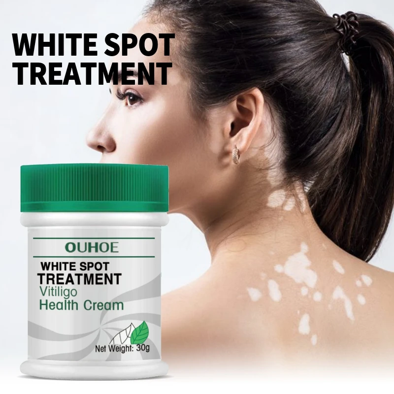 

30g White Spot Treatment Disease Cream Ointment Leukoplakia Repair Vitiligo Pigment Melanin Skin Care Beauty Health Maquiagem