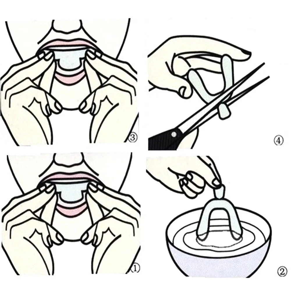 Protector bucal de silicona de 2/4 piezas para el cuidado de los dientes, bandeja para blanquear y moler las mordeduras dentales, ayuda para dormir