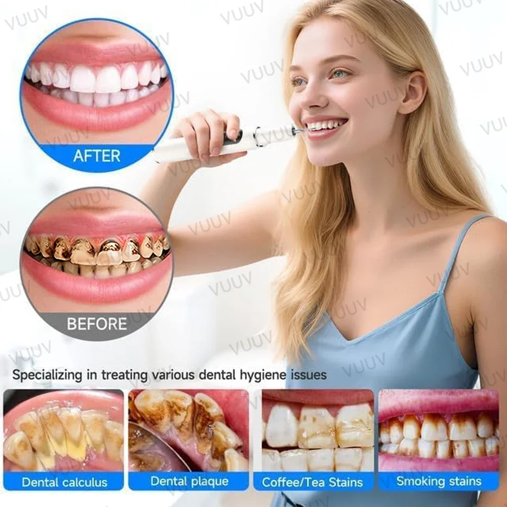 VUUV Ultrasonic Teeth Cleaner Women Tartar Remover Stain Eraser Multi Gear Type-C Rechargeable Portable Oral Care Tool