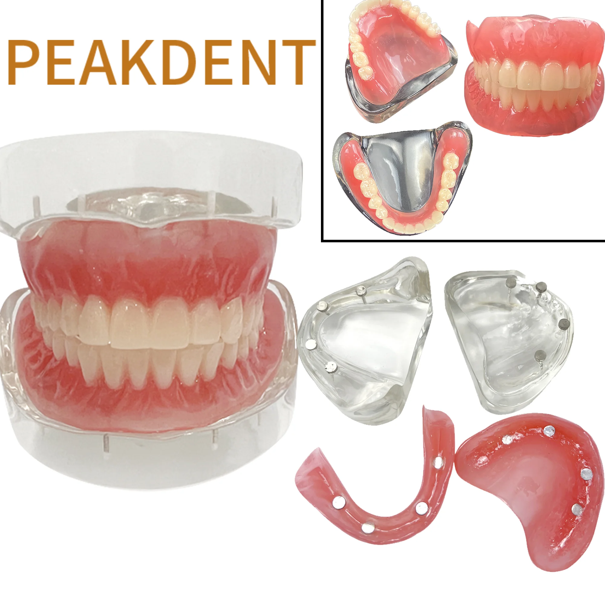 

1 шт., модель зубного протеза, магнитное крепление, съемные верхнекалиберные и щелочные зубы с реставрацией, обучающее исследование
