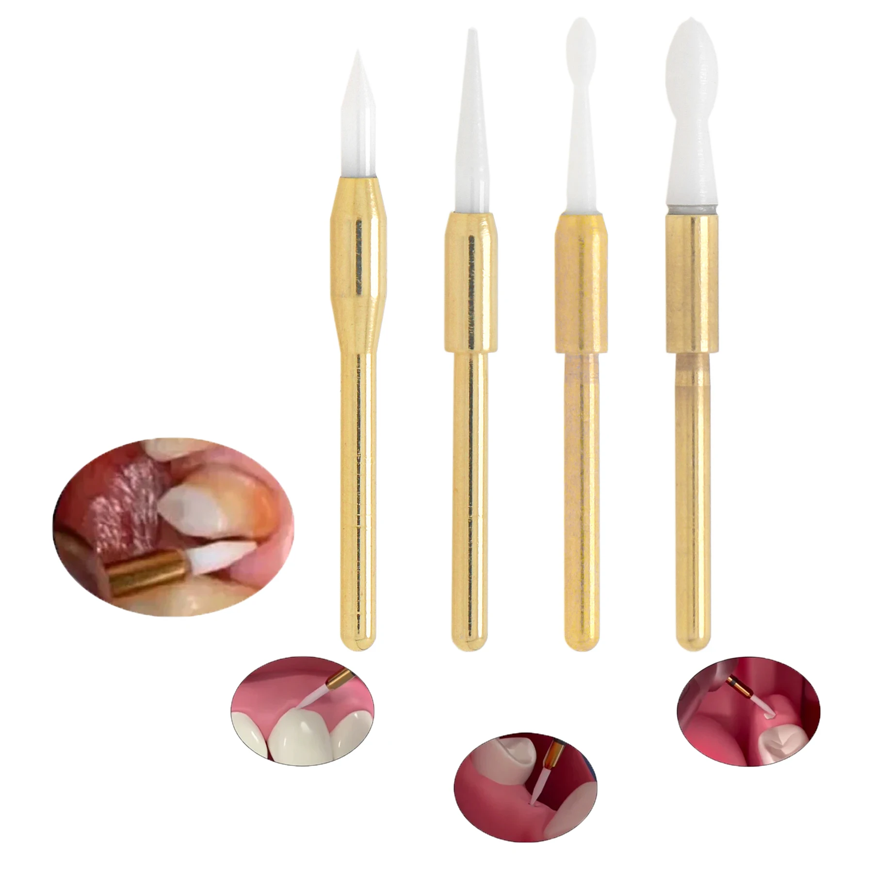 

Стоматологический триммер, керамические боры для мягких тканей, триммер для ясен, отбеливание зубов, инструмент для имплантата, чистка и отбеливание, продукт для стоматолога