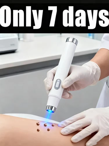 Verrugas mejoradas de 1a generación reparación de raíz de verrugas uickly 99