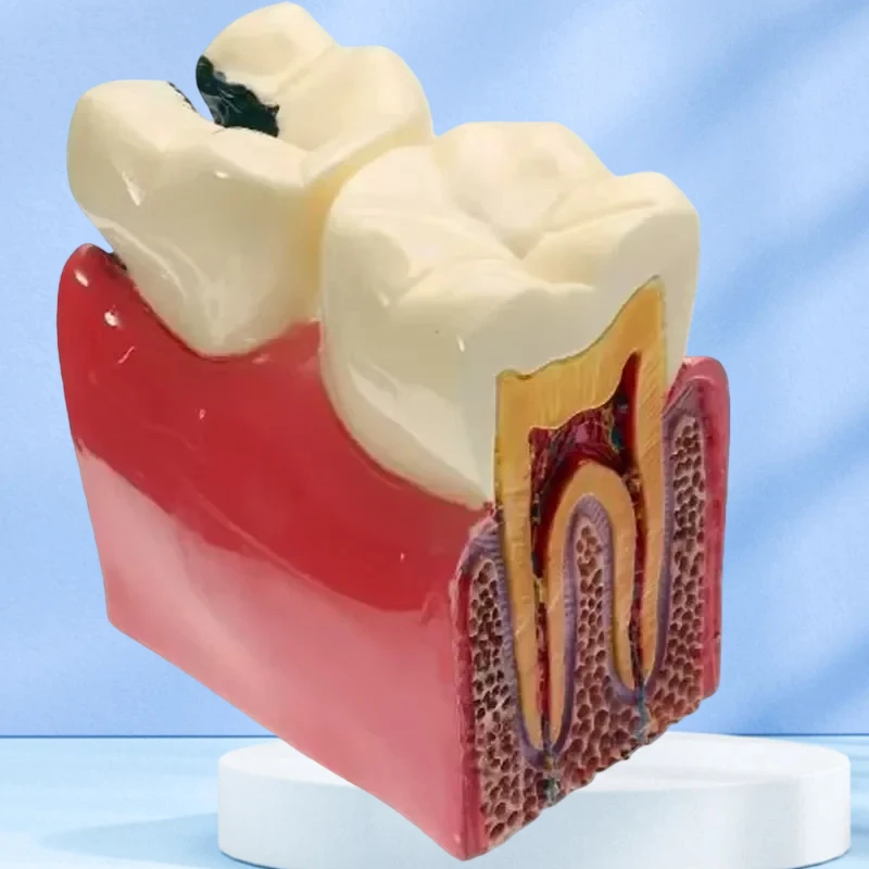 

Модель обучения зубами, стоматологические материалы, лабораторная модель зубов, 6-кратные исследования кариеса, модели для изучения сравнения