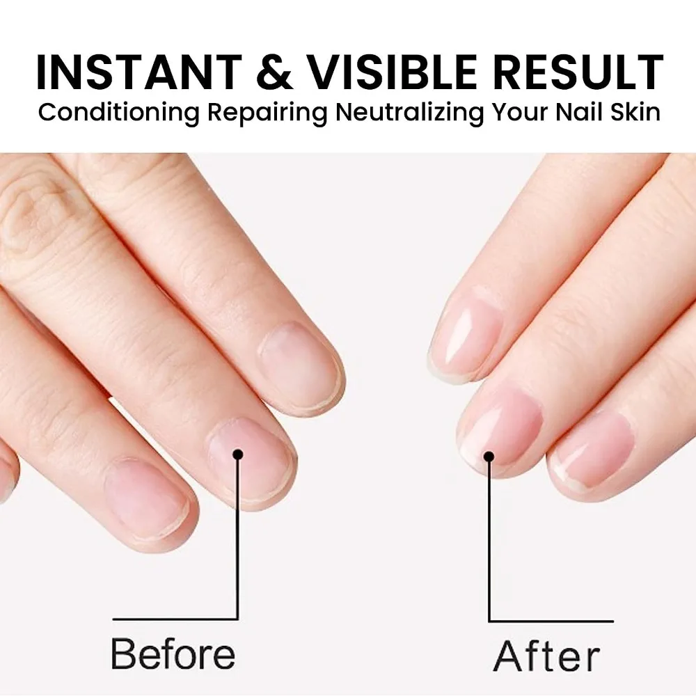 Nail Thickening Nail Strengthening Stratum corneum Oil 15ml Lavender/Tea Tree/Citrus Toenails Repair Oil Mild Rich Vitamin