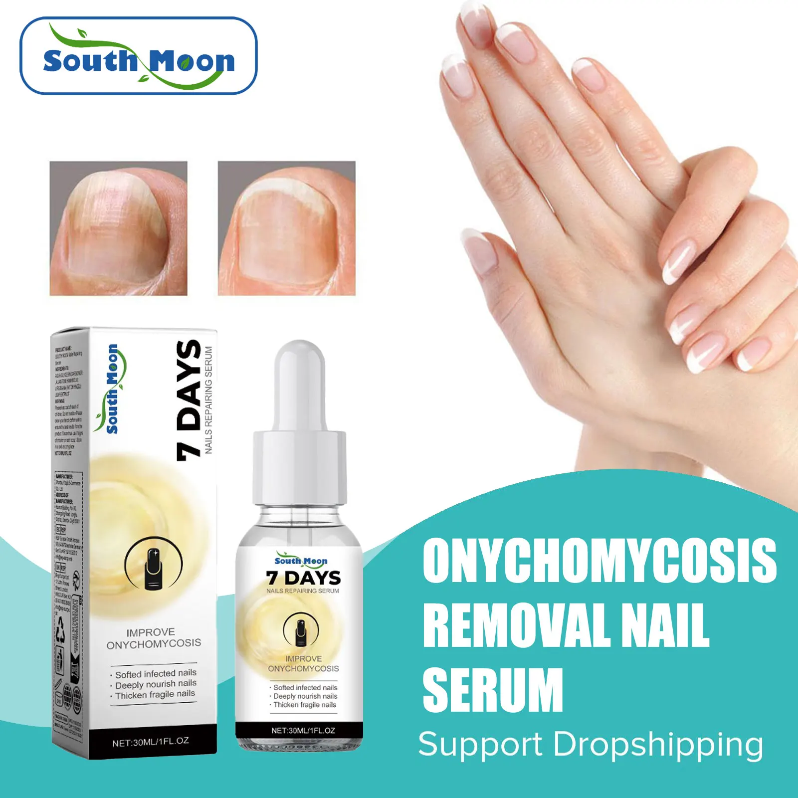 

Paronychia Treatment Care Liquid Anti Infection Repair Ingrown Toenail Improve Grey Nail Softening Onychomycosi Removal Essence