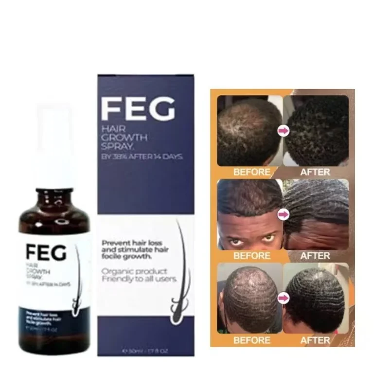 FEG Organic Anti Hair Loss Hair Growth Treatment Oil For Thicker Long Hair -50ML