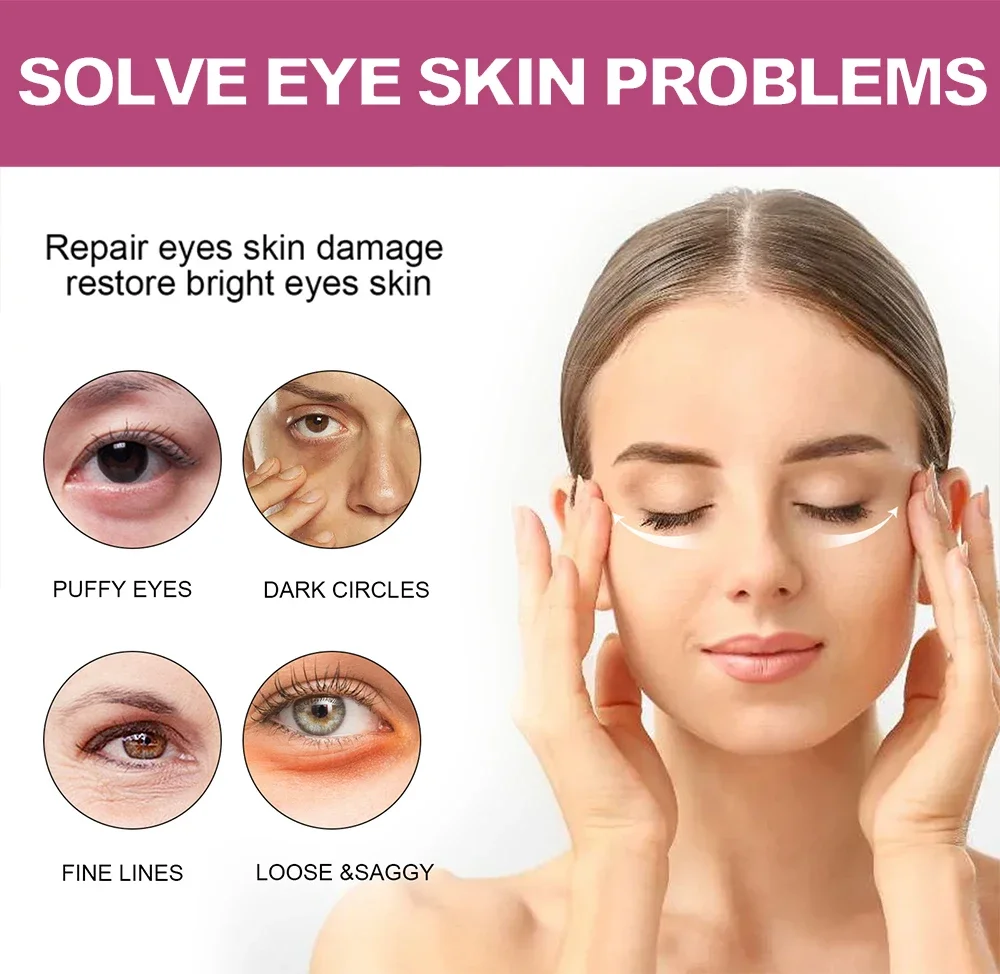 Anti-rugas círculos escuros creme para os olhos, remover bolsas oculares, Puffiness Way, trabalho sob os olhos, hidratação, branqueamento Cuidados com a pele, clareamento