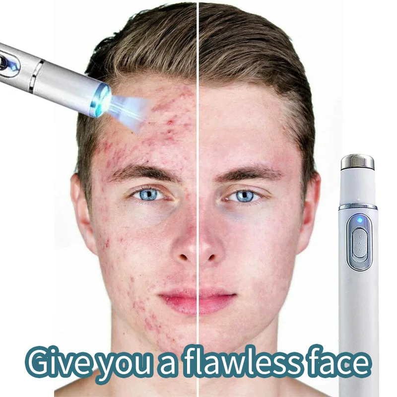 Face Blue Light Pen Scars Protects Cleanses Painless Laser Removes Acne Marks Portable