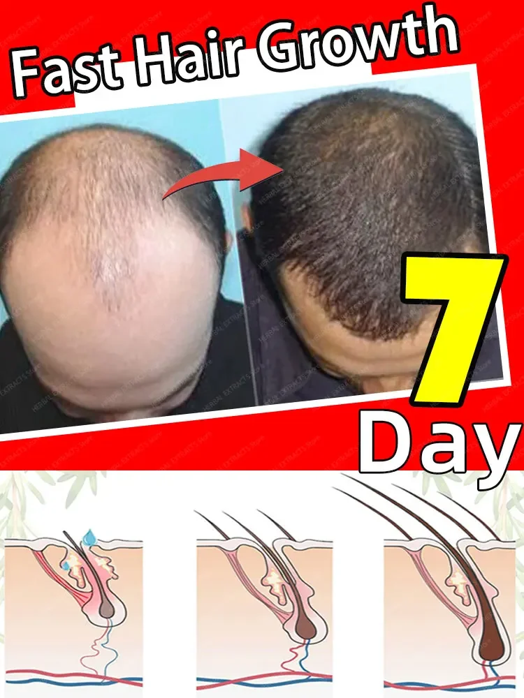 

Hot sale, more hair. Say goodbye to baldness, the secret to thick hair,Grow hair anywhere.