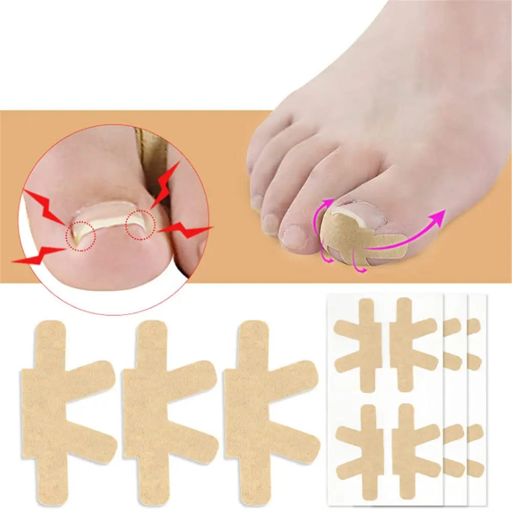 Универсальный-клейкий-пластырь-для-ногтей-на-ногах-наклейка-для-коррекции-вросшего-пальца-ног-корректор-для-ног-педикюр-инструменты-для-ухода-за-здоровьем-подушечка-для-лечения-пальцев-ног