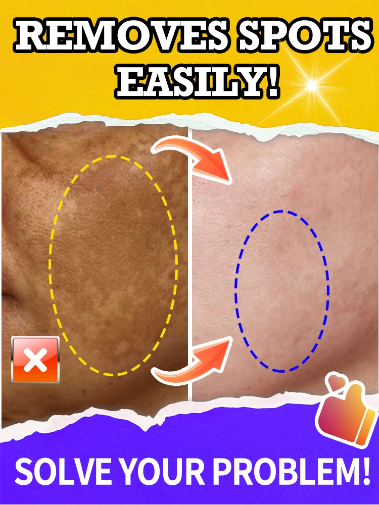 

Deal facial spots and solve dark