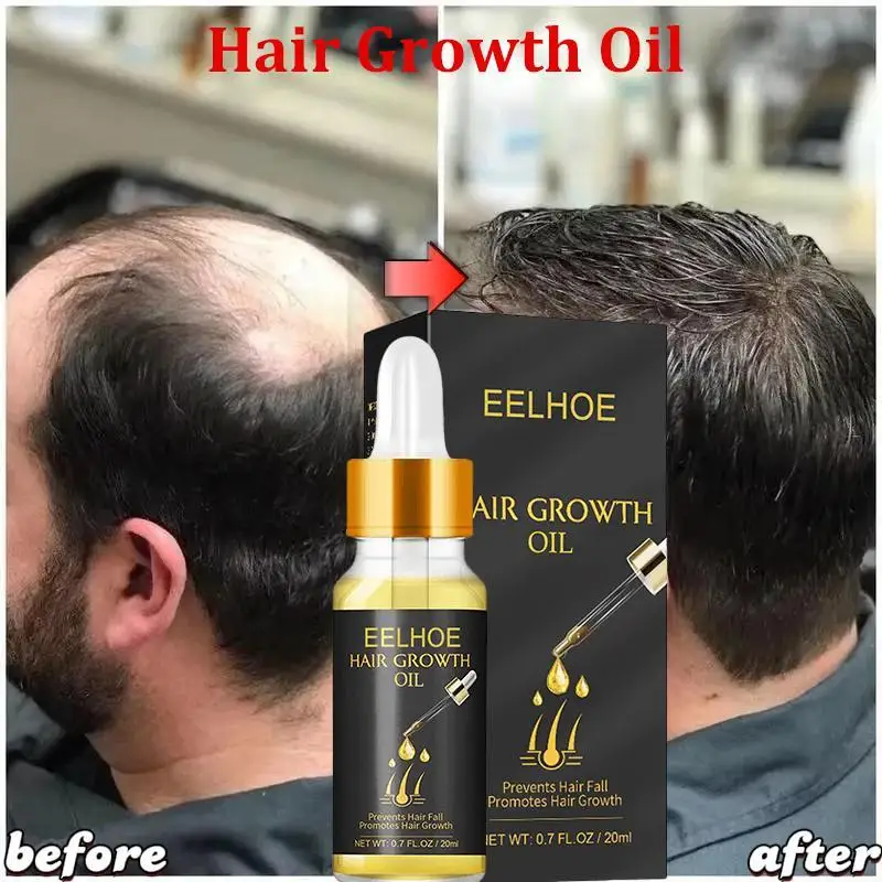 

Fast Hair Growth Serum Hair Regrowth Essential Oil Anti Hair loss Repair Damaged Scalp Women Men Anti Baldness Hair Growth Care