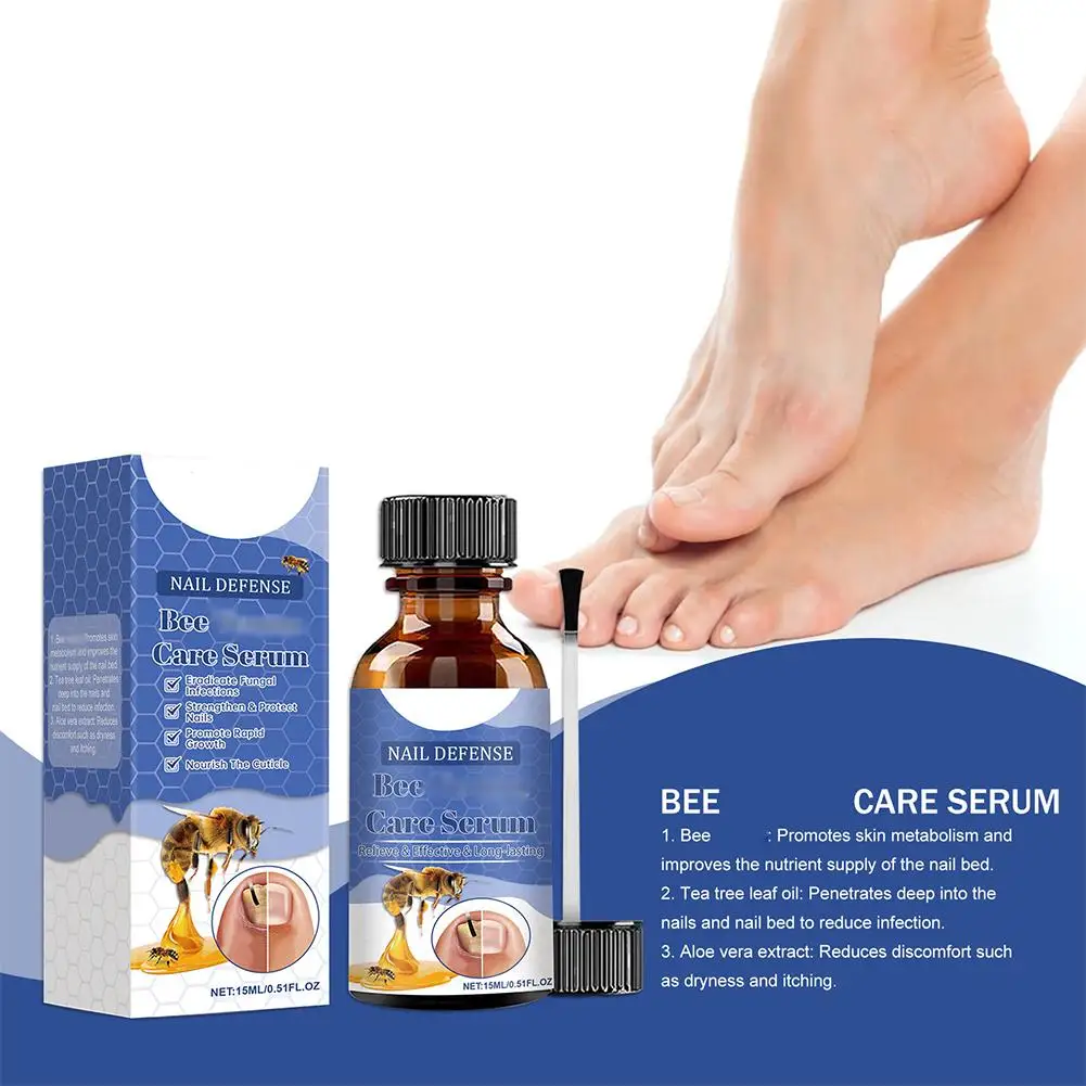 خلاصة العناية بفطر onycosis لسم النحل للأظافر والأظافر السميكة وأصابع القدم ، إصلاح سريع ، علاج ، العناية بالقدم ، 15 فطر