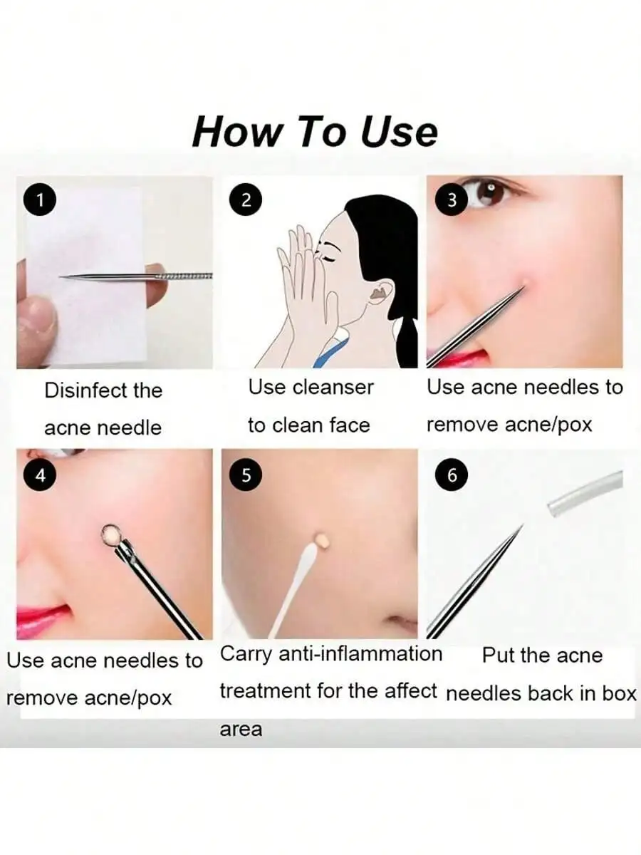 4-Piece Women Beauty Tools – Acne Comedone Remover & Whitehead Extraction Needles
