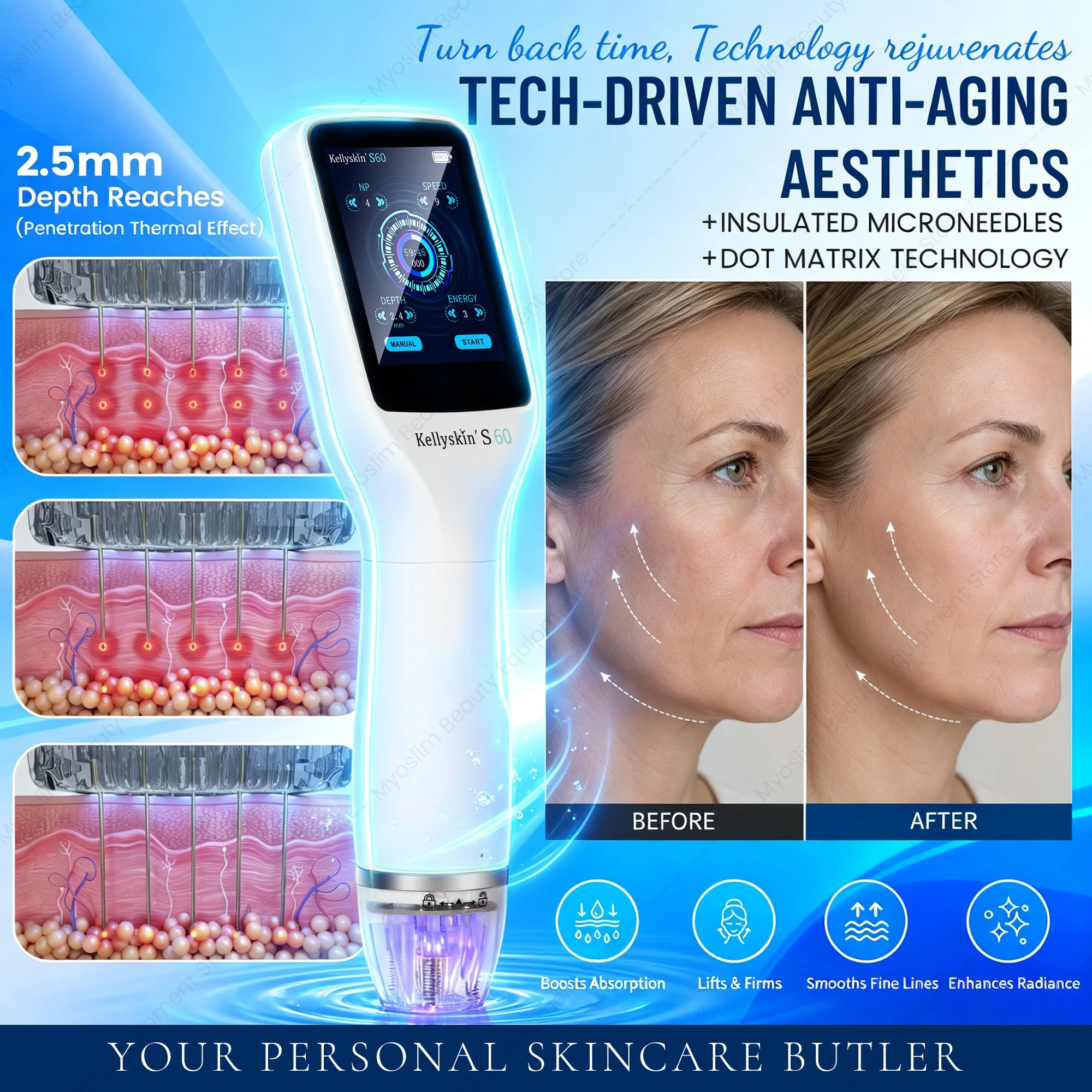 Dot Matrix Skin Rejuvenation Machine 2.5mm Deep Penetration Anti‑Aging Skin Tightening Wrinkle Remove SPA Salon Facial Device