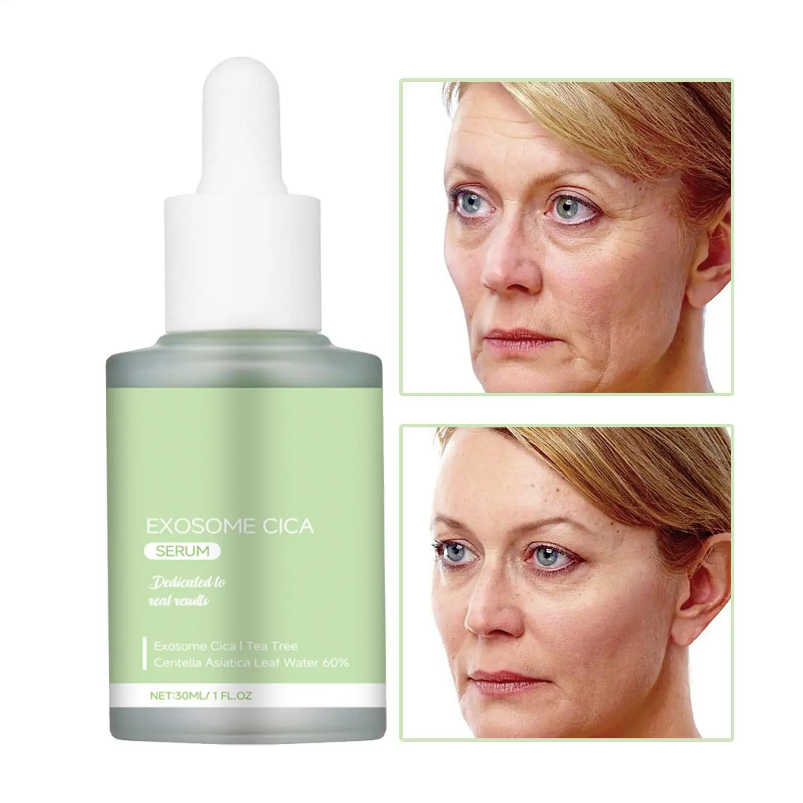 Facial Exosome Cica Essencs Facial Essencs Water Skin Hydrating Essencs Moisturizing 30ml Repairing Revitalize Renew