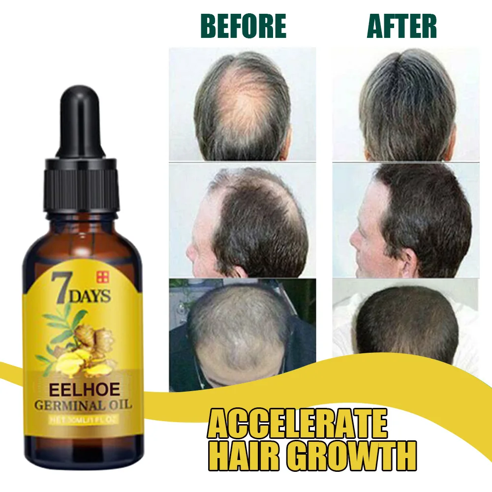 EELHOE Ginger Hair Care Solution for Hair Nourishing and Moisturizing Hair Care for Hair Stabilizing and Preventing Hair Loss