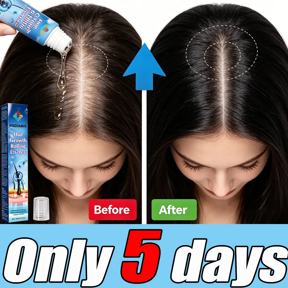 Hair Growth Roller，Optimize Scalp Condition, Relieve Dandruff & Itch for Healthier‑Looking Scalp & Fuller‑Looking Hair