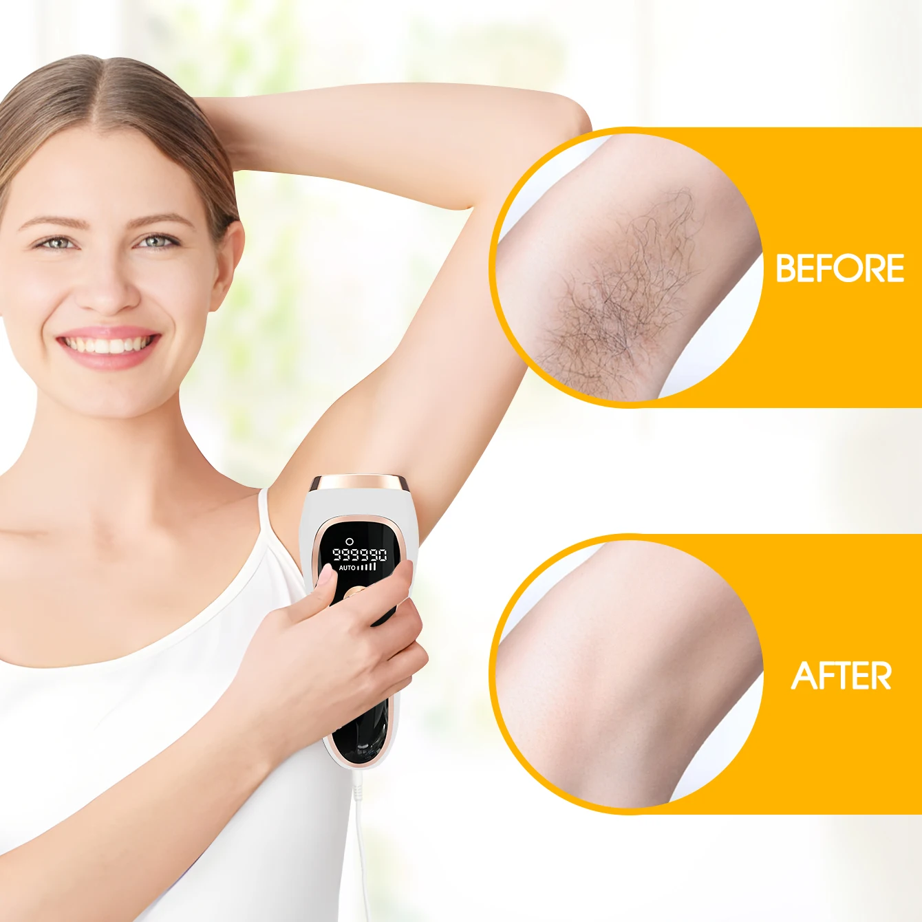 5 Stufen IPL Laser Haarentfernung 999.990 Blitze Epilierer für Frauen Bikinis Beine Körper Haarentfernungsgerät Achseln Photoepilator