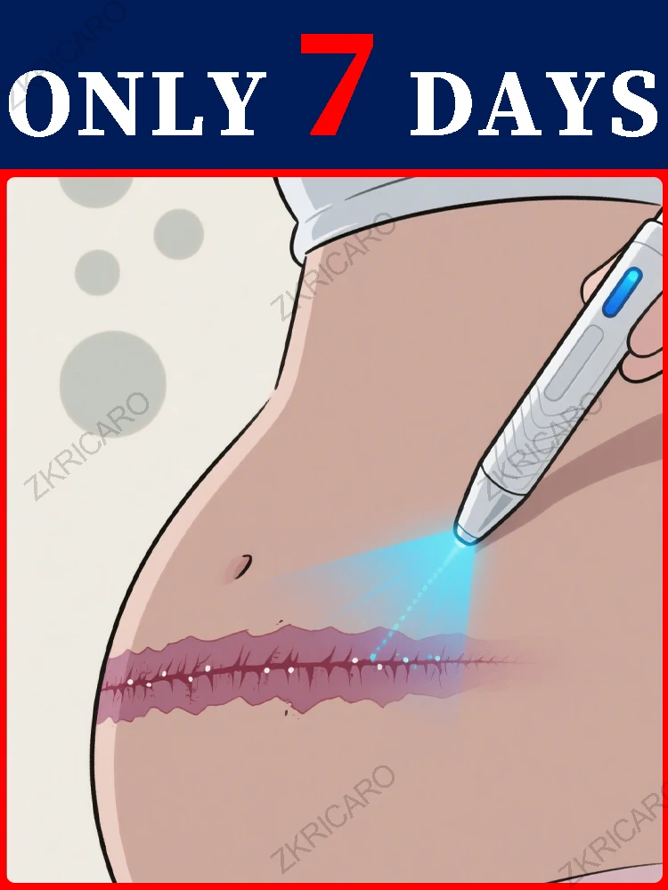 The latest laser equipment in 2025 will restore your skin to health!