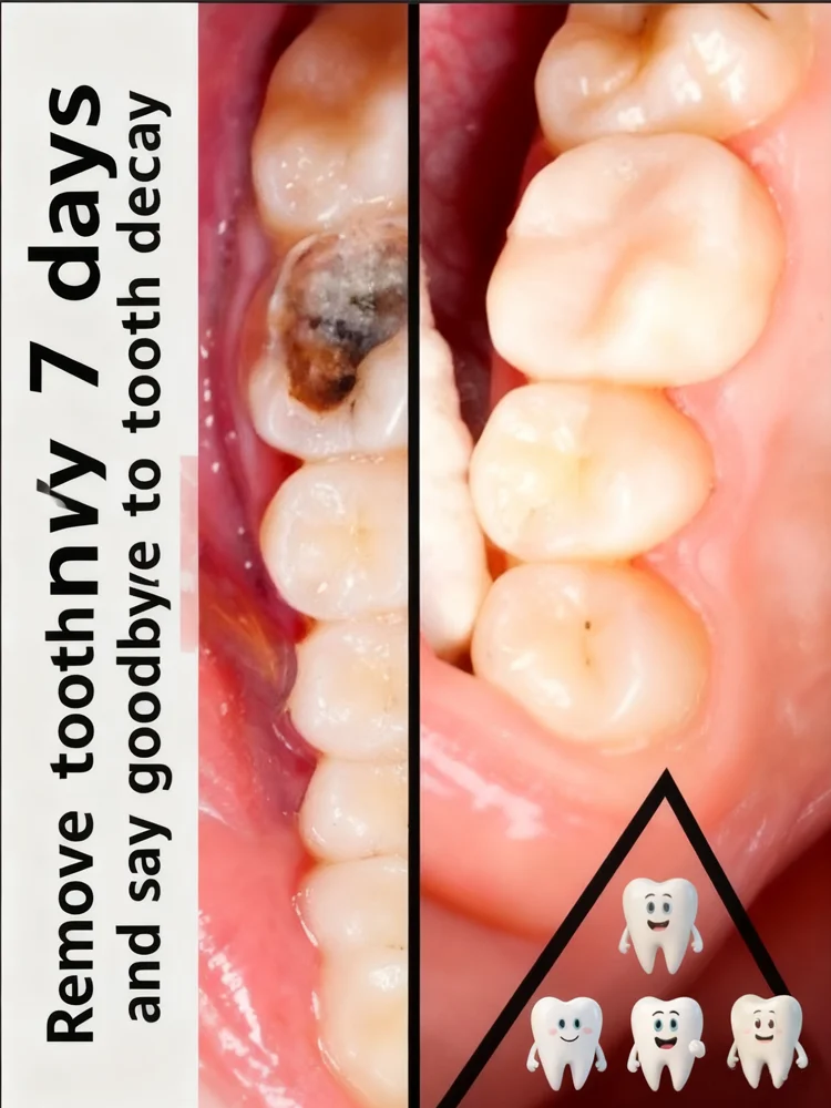 

Вау! Эта зубная паста стирает пятна кофе в 1 неделю! Никаких чувствительных зубов! Эта зубная паста — это сменщик игр!
