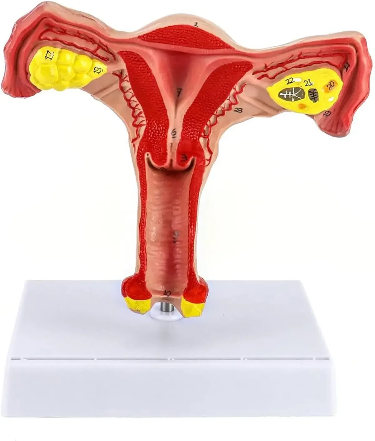 1:1 Human Female Uterus and Ovary Model Female Genital Organ Uterine Teaching Anatomical Gynecology Uterus and Ovary Model