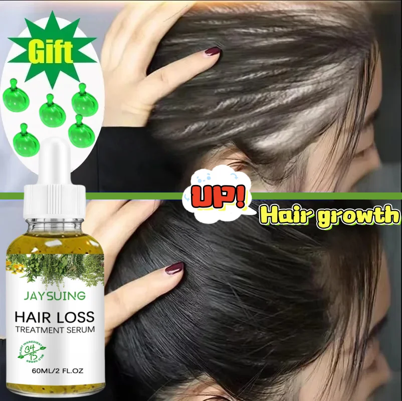 

Масло для быстрого роста волос Africa Crazy Traction Alopecia Serum против выпадения волос, спрей для лечения выпадения волос для мужчин и женщин, 60 мл