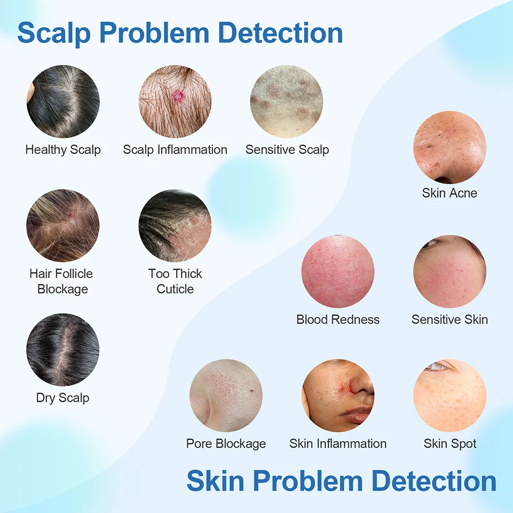 แบบพกพารูขุมขนหนังศีรษะเครื่องตรวจจับ 4X แว่นขยาย Pore แว่นขยายเครื่องทดสอบผิวหน้าเครื่องวิเคราะห์ผมหนังศีรษะเครื่องวินิจฉัย