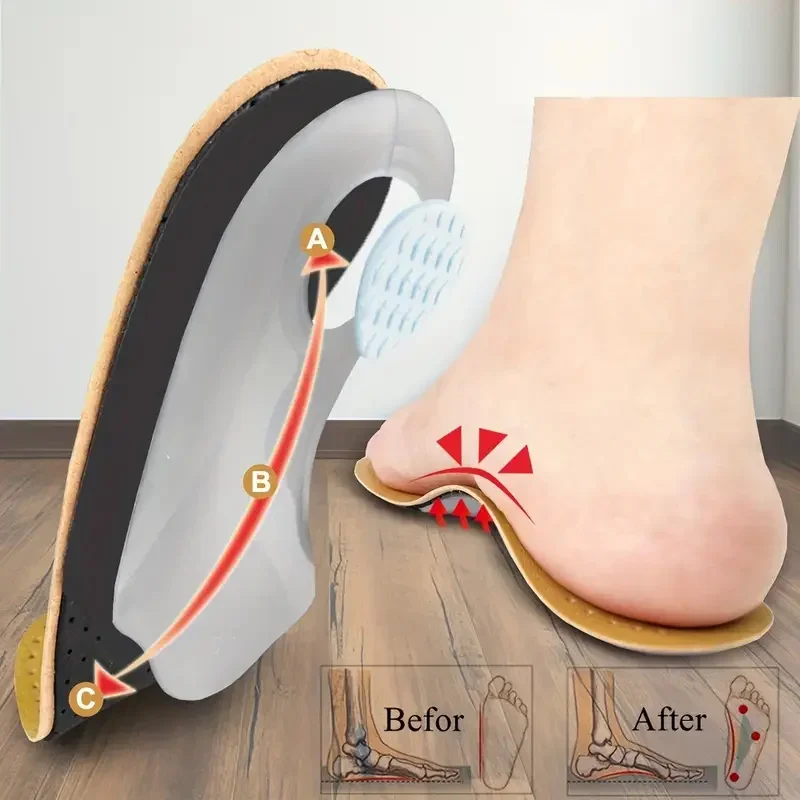 1 Pair Leather Orthopedic Insoles Orthotic Arch Support Instep Flat Foot Shoe Pad Fit In O/X Leg Corrected Insert