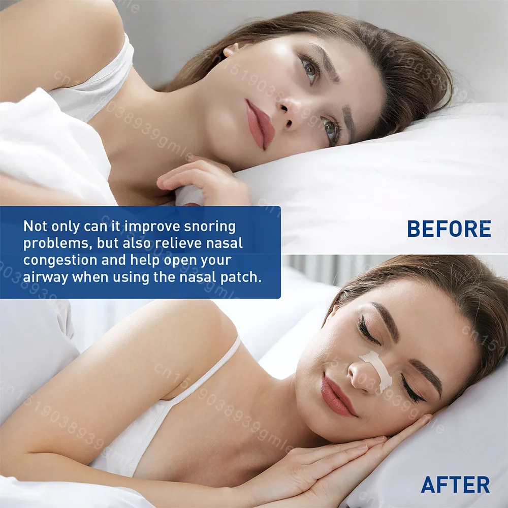 

Ventilation Nasal Patch Anti Snoring Nasal Blockage Physical Expansion of Nostrils To Stop Snoring Breathlessness Nasal Patch