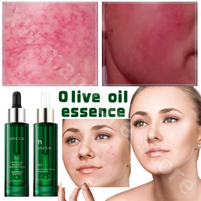 40% Olive Essence Soothes The Skin Barrier Improves Dullness Slows Down Facial Redness and Nourishes The Essence Serum Facial