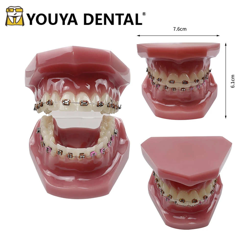 

Dental Model All Metal Orthodontic Teeth Model for Dental Technician Practice Training Studying Teaching Models