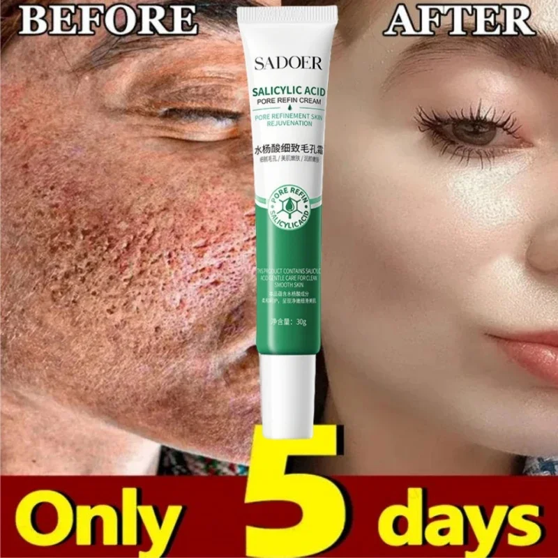 Salicylic Acid Pore Shrinking Cream Eliminate Large Pores Serum Remove Blackhead Acne Repairing Tightening Skin Care Cosmetics