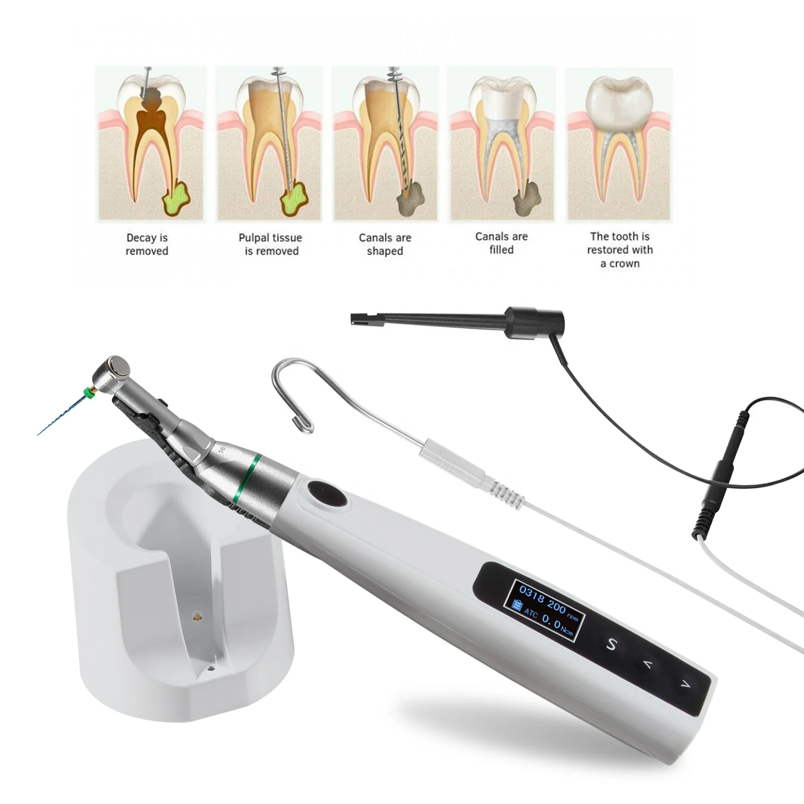 New Innovation!  den tal Endo Motor Endodontics Treatment LED Root Canal Handpiece 16:1 Ratio Built in Apex Locator 2in1 Cordles